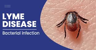 Lyme Disease